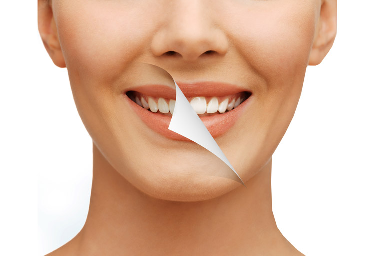 odontologia-estetica-marcelo-venerando-ortodontia