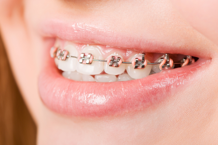 ortodontia-marcelo-venerando